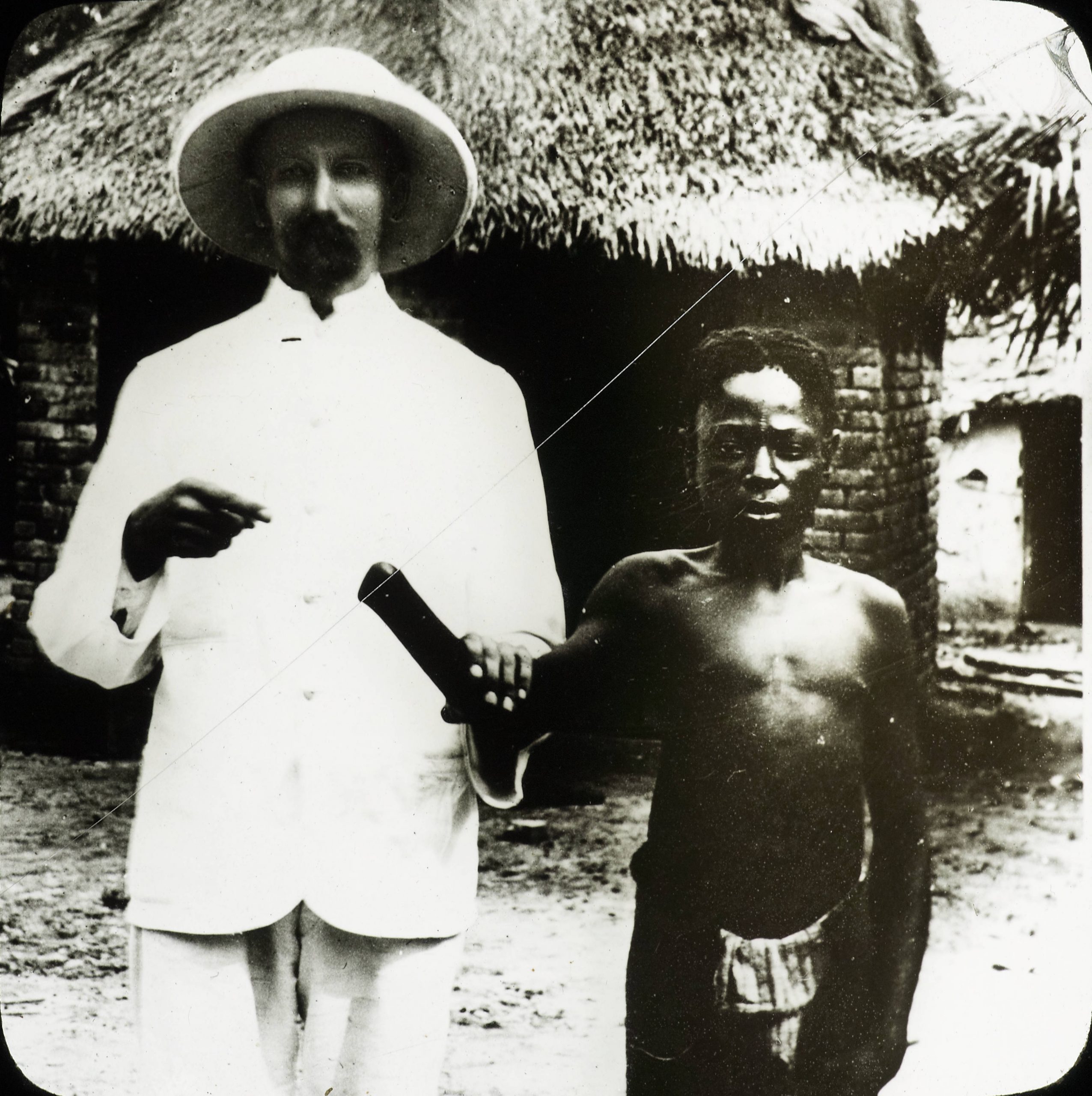 Hvit mann med hatt og hvit frakk viser fram armen til en svart mann som har fått sin hånd avkuttet